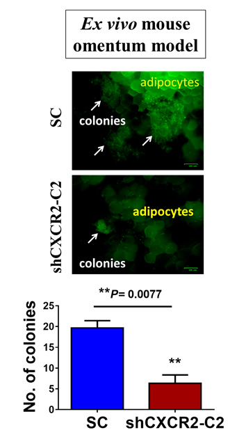 The immunofluorescent analysis shows the knockdown of CXCR2 reduces the capacity of ovarian cancer (GFP-labelled) in omental colonization using the ex vivo mouse omentum model.